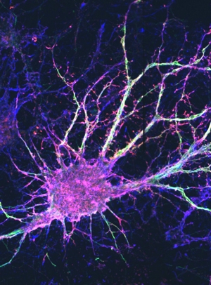 A colorful network of neurons.